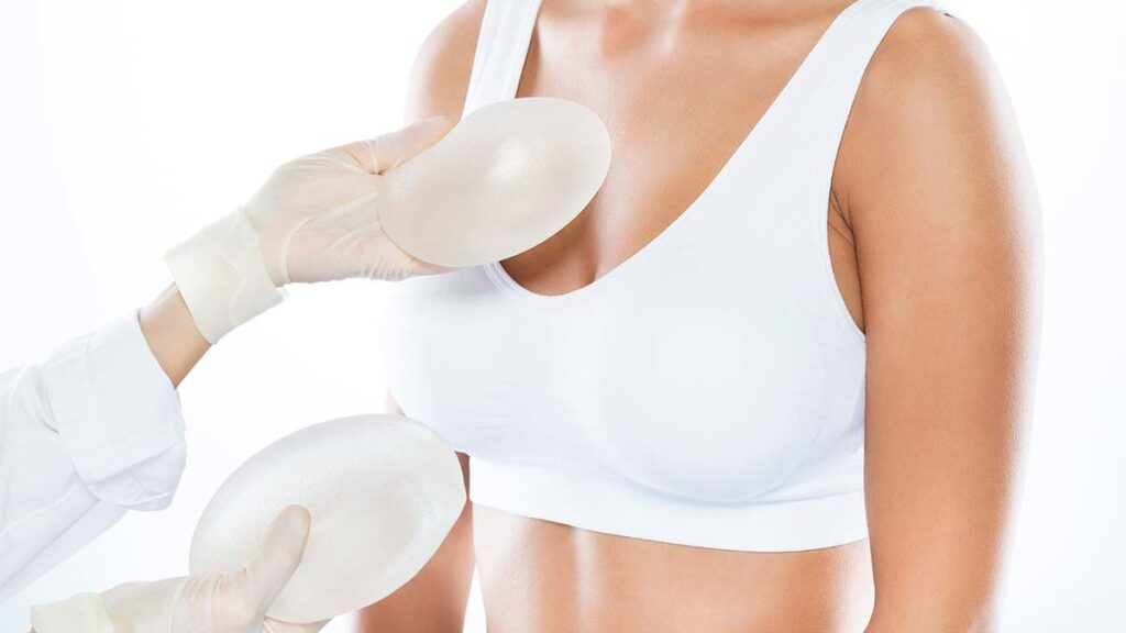 Retirada da prótese de silicone